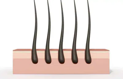 hair follicle test